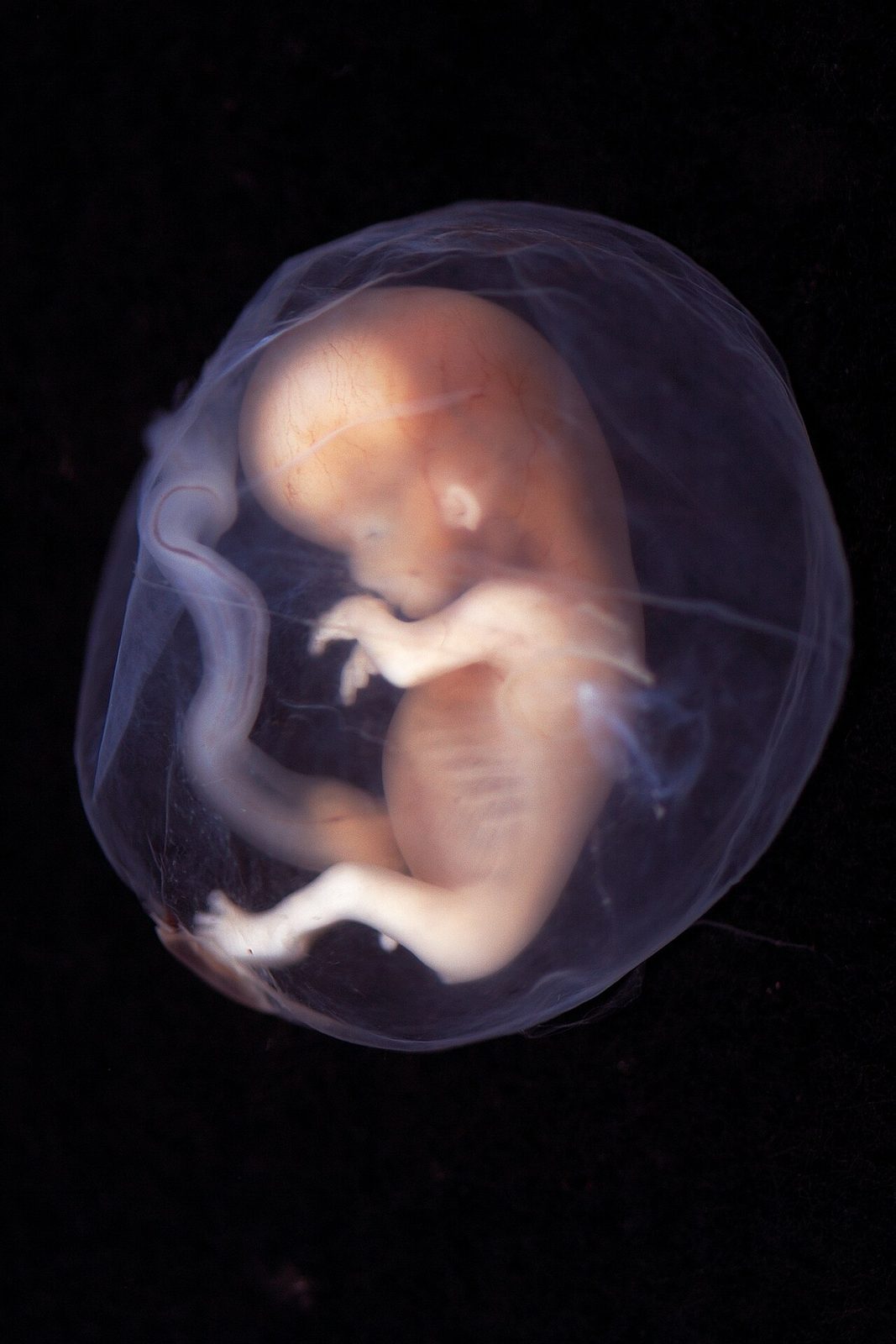 embryo