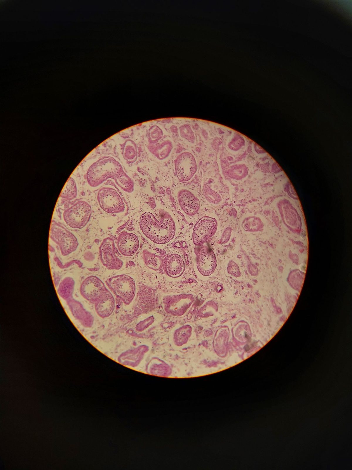 embryo
